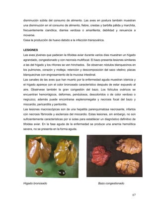 67
disminución súbita del consumo de alimento. Las aves en postura también muestran
una disminución en el consumo de alimento, fiebre, crestas y barbilla pálida y marchita,
frecuentemente cianótica, diarrea verdosa o amarillenta; debilidad y renuencia a
moverse.
Cesa la producción de huevo debido a la infección transovárica.
LESIONES
Las aves jóvenes que padecen la tifoidea aviar durante varios días muestran un hígado
agrandado, congestionado y con necrosis multifocal. El bazo presenta lesiones similares
a las del hígado y los riñones se ven hinchados. Se observan nódulos blanquecinos en
los pulmones, corazón y molleja; retención y descomposición del saco vitelino; placas
blanquecinas con engrosamiento de la mucosa intestinal.
Las canales de las aves que han muerto por la enfermedad aguda muestran ictericia y
el hígado aparece con el color bronceado característico después de estar expuesto al
aire. Obsérvese también la gran congestión del bazo. Los folículos ováricos se
encuentran hemorrágicos, deformes, pendulosos, descoloridos o de color verdoso o
negruzco; además puede encontrarse esplenomegalia y necrosis focal del bazo y
miocardio, pericarditis y peritonitis.
Las lesiones macroscópicas son de una hepatitis parenquimatosa necrosante, infartos
con necrosis fibrinoide y esclerosis del miocardio. Estas lesiones, sin embargo, no son
suficientemente características por si solas para establecer un diagnóstico definitivo de
tifoidea aviar. En la fase aguda de la enfermedad se produce una anemia hemolítica
severa, no se presenta en la forma aguda.
Hígado bronceado Bazo congestionado
 