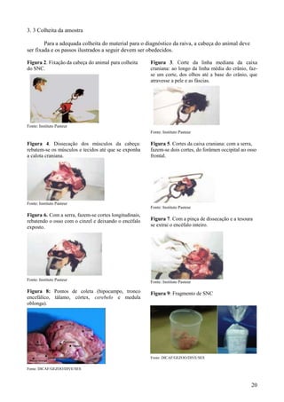 20
3. 3 Colheita da amostra
Para a adequada colheita do material para o diagnóstico da raiva, a cabeça do animal deve
ser fixada e os passos ilustrados a seguir devem ser obedecidos.
Figura 2. Fixação da cabeça do animal para colheita
do SNC.
Fonte: Instituto Pasteur
Figura 4. Dissecação dos músculos da cabeça:
rebatem-se os músculos e tecidos até que se exponha
a calota craniana.
Fonte: Instituto Pasteur
Figura 6. Com a serra, fazem-se cortes longitudinais,
rebatendo o osso com o cinzel e deixando o encéfalo
exposto.
Fonte: Instituto Pasteur
Figura 8: Pontos de coleta (hipocampo, tronco
encefálico, tálamo, córtex, cerebelo e medula
oblonga).
Fonte: DICAF/GEZOO/DIVE/SES
Figura 3. Corte da linha mediana da caixa
craniana: ao longo da linha média do crânio, faz-
se um corte, dos olhos até a base do crânio, que
atravesse a pele e as fáscias.
Fonte: Instituto Pasteur
Figura 5. Cortes da caixa craniana: com a serra,
fazem-se dois cortes, do forâmen occipital ao osso
frontal.
Fonte: Instituto Pasteur
Figura 7. Com a pinça de dissecação e a tesoura
se extrai o encéfalo inteiro.
Fonte: Instituto Pasteur
Figura 9: Fragmento de SNC
Fonte: DICAF/GEZOO/DIVE/SES
 