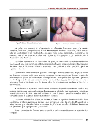 Condutas para Úlceras Neurotróficas e Traumáticas

Figura 7 - Fissura dos membros superiores.

Figura 8 - Fissura dos membros inferiores.

A mudança na anatomia do pé ocasionada por alterações da estrutura óssea cria pressões
anormais, facilitando o surgimento de úlceras. O outro fator funcional é a marcha, isto é, além da
falta de sensibilidade, o pé é submetido a esforços, como longas caminhadas, passos largos ou
corridas, presença de objetos estranhos nos calçados (pedras, pregos), o que contribui para o
desenvolvimento da úlcera.
As úlceras neurotróficas são classificadas em graus, de acordo com o comprometimento dos
tecidos, desde uma lesão superficial até lesões mais profundas, com comprometimento de articulação,
tendões e ossos, sendo muito comum a osteomielite, com posterior necrose, gangrena e perda de
segmentos ósseos.
A calosidade (espessamento da queratina causada pela pressão dos tecidos à fricção) e tensões
nas áreas que suportam maior peso, também constituem risco para as úlceras. Quando os calos são
pouco espessos, podem ser considerados como protetores, mas quando sua espessura é grande e
sua localização se dá em áreas com diminuição da sensibilidade, prejudicam os tecidos moles e
tornam-se fatores predisponentes de úlcera, além de serem comuns nas bordas das úlceras
neurotróficas.
Considerando-se a perda da sensibilidade e o aumento da pressão como fatores de risco para
o desenvolvimento de úlceras, algumas medidas podem ser adotadas para monitorar a evolução da
pressão nessas áreas de risco, como: orientação sobre o uso de calçado, palmilhas especiais ,sobre as
atividades diárias e adaptação dos instrumentos de trabalho.
As úlceras neurotróficas podem ser descritas a partir das seguintes características: são lesões
anestésicas, circulares, geralmente quentes e não apresentam sinais de infecção. Desenvolvem-se
sobre áreas de proeminências ósseas, com maior freqüência nos membros inferiores. Geralmente
são precedidas por hiperqueratose (calosidades).
Para a prevenção das fissuras, lesões traumáticas e úlceras consideram-se as ações descritas
a seguir:

Manual de Reabilitação em Hanseníase

19

 