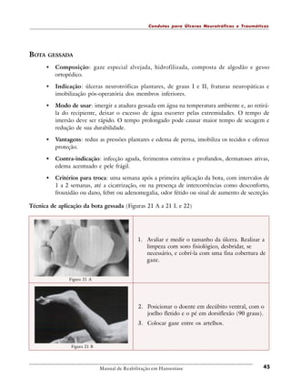Condutas para Úlceras Neurotróficas e Traumáticas

BOTA

GESSADA

•

Composição: gaze especial alvejada, hidrofilizada, composta de algodão e gesso
ortopédico.

•

Indicação: úlceras neurotróficas plantares, de graus I e II, fraturas neuropáticas e
imobilização pós-operatória dos membros inferiores.

•

Modo de usar: imergir a atadura gessada em água na temperatura ambiente e, ao retirála do recipiente, deixar o excesso de água escorrer pelas extremidades. O tempo de
imersão deve ser rápido. O tempo prolongado pode causar maior tempo de secagem e
redução de sua durabilidade.

•

Vantagens: reduz as pressões plantares e edema de perna, imobiliza os tecidos e oferece
proteção.

•

Contra-indicação: infecção aguda, ferimentos estreitos e profundos, dermatoses ativas,
edema acentuado e pele frágil.

•

Critérios para troca: uma semana após a primeira aplicação da bota, com intervalos de
1 a 2 semanas, até a cicatrização, ou na presença de intercorrências como desconforto,
frouxidão ou dano, febre ou adenomegalia, odor fétido ou sinal de aumento de secreção.

Técnica de aplicação da bota gessada (Figuras 21 A a 21 L e 22)

1. Avaliar e medir o tamanho da úlcera. Realizar a
limpeza com soro fisiológico, desbridar, se
necessário, e cobrí-la com uma fina cobertura de
gaze.

Figura 21 A

2. Posicionar o doente em decúbito ventral, com o
joelho fletido e o pé em dorsiflexão (90 graus).
3. Colocar gaze entre os artelhos.

Figura 21 B

Manual de Reabilitação em Hanseníase

45

 