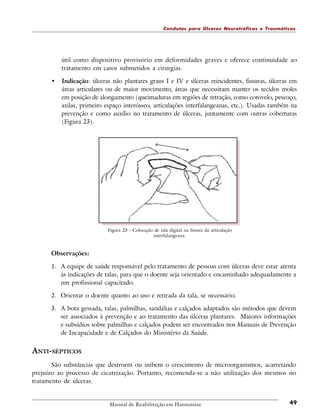 Condutas para Úlceras Neurotróficas e Traumáticas

útil como dispositivo provisório em deformidades graves e oferece continuidade ao
tratamento em casos submetidos a cirurgias.

•

Indicação: úlceras não plantares graus I e IV e úlceras reincidentes, fissuras, úlceras em
áreas articulares ou de maior movimento, áreas que necessitam manter os tecidos moles
em posição de alongamento (queimaduras em regiões de retração, como cotovelo, pescoço,
axilas, primeiro espaço interósseo, articulações interfalangeanas, etc.). Usadas também na
prevenção e como auxílio no tratamento de úlceras, juntamente com outras coberturas
(Figura 23).

Figura 23 - Colocação de tala digital na fissura da articulação
interfalangeana.

Observações:
1. A equipe de saúde responsável pelo tratamento de pessoas com úlceras deve estar atenta
às indicações de talas, para que o doente seja orientado e encaminhado adequadamente a
um profissional capacitado.
2. Orientar o doente quanto ao uso e retirada da tala, se necessário.
3. A bota gessada, talas, palmilhas, sandálias e calçados adaptados são métodos que devem
ser associados à prevenção e ao tratamento das úlceras plantares. Maiores informações
e subsídios sobre palmilhas e calçados podem ser encontrados nos Manuais de Prevenção
de Incapacidade e de Calçados do Ministério da Saúde.

ANTI-SÉPTICOS
São substâncias que destroem ou inibem o crescimento de microorganismos, acarretando
prejuízo ao processo de cicatrização. Portanto, recomenda-se a não utilização dos mesmos no
tratamento de úlceras.

Manual de Reabilitação em Hanseníase

49

 