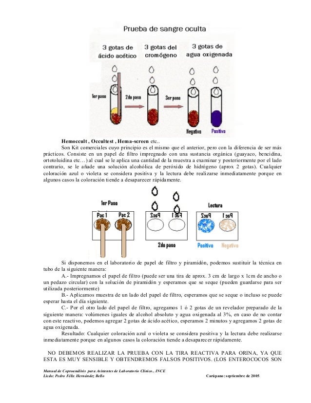 Prueba De Sangre Oculta En Heces Con Agua Oxigenada Marcus Reid