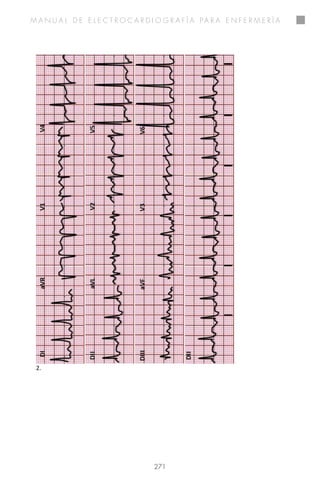 Manual de electrocardiografia para enfermeria - 2014