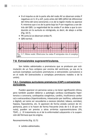 Manual de electrocardiografia para enfermeria - 2014