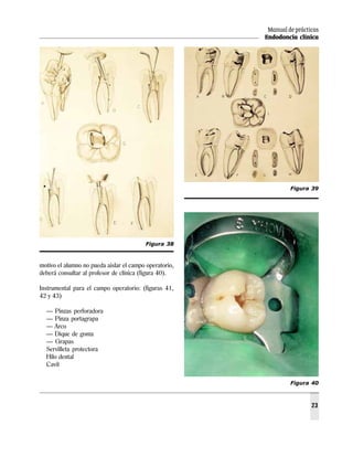 Manual de prácticas
                                                        Endodoncia clínica




                                                                 Figura 39




                                         Figura 38



motivo el alumno no pueda aislar el campo operatorio,
deberá consultar al profesor de clínica (figura 40).

Instrumental para el campo operatorio: (figuras 41,
42 y 43)

  — Pinzas perforadora
  — Pinza portagrapa
  — Arco
  — Dique de goma
  — Grapas
  Servilleta protectora
  Hilo dental
  Cavit

                                                                 Figura 40



                                                                         23
 