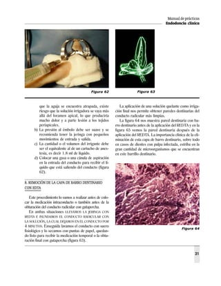 Manual de prácticas
                                                                                            Endodoncia clínica




                                            Figura 62                    Figura 63



         que la aguja se encuentra atrapada, existe           La aplicación de una solución quelante como irriga-
         riesgo que la solución irrigadora se vaya más     ción final nos permite obtener paredes dentinarias del
         allá del foramen apical, lo que produciría        conducto radicular más limpias.
         mucho dolor y a parte lesión a los tejidos           La figura 64 nos muestra pared dentinaria con ba-
         periapicales.                                     rro dentinario antes de la aplicación del REDTA y en la
      b) La presión al émbolo debe ser suave y se          figura 65 vemos la pared dentinaria después de la
         recomienda tener la jeringa con pequeños          aplicación del REDTA. La importancia clínica de la eli-
         movimientos de entrada y salida.                  minación de esta capa de barro dentinario, sobre todo
      c) La cantidad o el volumen del irrigante debe       en casos de dientes con pulpa infectada, estriba en la
         ser el equivalente al de un cartucho de anes-     gran cantidad de microorganismos que se encuentran
         tesia, es decir 1.8 ml de líquido.                en este barrillo dentinario.
      d) Colocar una gasa o una cánula de aspiración
         en la entrada del conducto para recibir el lí-
         quido que está saliendo del conducto (figura
         62).

8. REMOCIÓN DE LA CAPA DE BARRO DENTINARIO
CON EDTA

   Este procedimiento lo vamos a realizar antes de colo-
car la medicación intraconducto o también antes de la
obturación del conducto radicular con gutapercha.
   En ambas situaciones LLEVAMOS LA JERINGA CON
REDTA E INUNDAMOS EL CONDUCTO RADICULAR CON
LA SOLUCIÓN, LA CUAL DEJAMOS EN EL CONDUCTO POR
4 MINUTOS. Enseguida lavamos el conducto con suero
                                                                                                      Figura 64
fisiológico y lo secamos con puntas de papel, quedan-
do listo para recibir la medicación temporal o la obtu-
ración final con gutapercha (figura 63).


                                                                                                               31
 