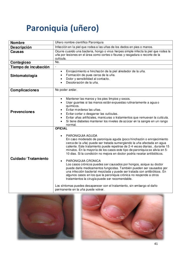 Que preparados del hongo en las orejas