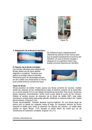Enfermera: Rocío Burelo Cruz 93
Figura 7a Figura 7b
7. Adaptación de la férula al miembro:
Se moldea el yeso cuidadosamente
utilizando las palmas de las manos para
que se ajuste exactamente al contorno del
miembro, sin que se formen arrugas o
pliegues en su superficie interior que
puedan provocar lesiones por decúbito.
8. Fijación de la férula (vendaje):
Las vendas utilizadas para asegurar las
férulas deben ser de trama abierta
(algodón o muselina). Tenemos que
aplicar el vendaje sobre el miembro
firmemente pero sin demasiada presión,
sin dar vueltas a la venda sobre sí misma,
pues puede producir constricción local.
Tipos de férula
Férula posterior de tobillo: Puede usarse una férula corriente sin recortar, medida
desde las cabezas de los metatarsianos hasta el extremo superior de la pantorrilla,
en un punto situado 3-4 cm por debajo del tubérculo de la tibia. Para el pie, donde los
dedos requieren inmovilización, tomar como punto distal la punta de los mismos.
Debido al cambio brusco de dirección de la férula de tobillo (90º), ésta debe
recortarse a ambos lados para poder alisarla, doblando un extremo sobre otro. Véase
técnica básica. (Figuras 8 y 9).
Férula isquiomaleolar: También llamada inguino-maleolar. Es una férula larga de
pierna que va desde los maleolos hasta la ingle. Es necesario reforzar de forma
especial el tobillo para evitar la aparición de úlceras por presión. La rodilla debe
quedar en ligera flexión. (15º) excepto si existe lesión de rotula que ha de
mantenerse en extensión completa. (Figuras 10 y 11).
 