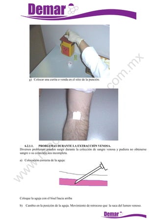 g) Colocar una curita o venda en el sitio de la punción.
6.2.1.1. PROBLEMAS DURANTE LA EXTRACCIÓN VENOSA.
Diversos problemas pueden surgir durante la colección de sangre venosa y pudiera no obtenerse
sangre o su colección sea incompleta.
a) Colocación correcta de la aguja:
Coloque la aguja con el bisel hacia arriba
b) Cambio en la posición de la aguja. Movimiento de retroceso que la saca del lumen venoso.
 
