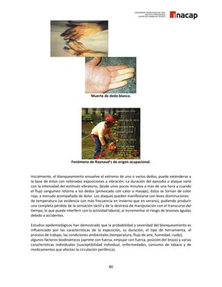 80
Muerte de dedo blanco.
Fenómeno de Raynaud’s de origen ocupacional.
Inicialmente, el blanqueamiento envuelve el extremo de uno o varios dedos, puede extenderse a
la base de éstos con reiteradas exposiciones a vibración. La duración del episodio o ataque varía
con la intensidad del estímulo vibratorio, desde unos pocos minutos a más de una hora y cuando
el flujo sanguíneo retorna a los dedos (provocado con calor o masaje), éstos se tornan de color
rojo, a menudo acompañado de dolor. Los ataques pueden manifestarse con leves disminuciones
de temperatura (se evidencia con más frecuencia en invierno que en verano), pudiendo producir
una completa pérdida de la sensación táctil y de la destreza de manipulación con el transcurso del
tiempo, lo que puede interferir con la actividad laboral, al incrementar el riesgo de lesiones agudas
debido a accidentes.
Estudios epidemiológicos han demostrado que la probabilidad y severidad del blanqueamiento es
influenciado por las características de la exposición, su duración, el tipo de herramienta, el
proceso de trabajo, las condiciones ambientales (temperatura, flujo de aire, humedad, ruido),
algunos factores biodinámicos (apriete con fuerza, empujar con fuerza, posición del brazo) y varias
características individuales (susceptibilidad individual, enfermedades, consumo de tabaco y de
medicamentos que afectan la circulación periférica).
 