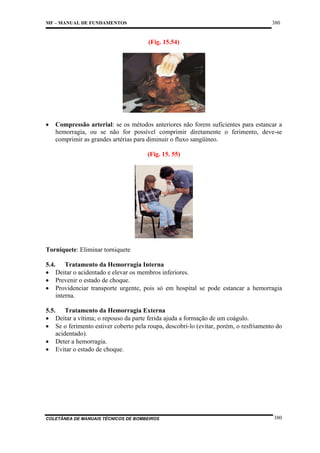 380

MF – MANUAL DE FUNDAMENTOS

(Fig. 15.54)

•

Compressão arterial: se os métodos anteriores não forem suficientes para estancar a
hemorragia, ou se não for possível comprimir diretamente o ferimento, deve-se
comprimir as grandes artérias para diminuir o fluxo sangüíneo.
(Fig. 15. 55)

Torniquete: Eliminar torniquete
5.4. Tratamento da Hemorragia Interna
• Deitar o acidentado e elevar os membros inferiores.
• Prevenir o estado de choque.
• Providenciar transporte urgente, pois só em hospital se pode estancar a hemorragia
interna.
5.5. Tratamento da Hemorragia Externa
• Deitar a vítima; o repouso da parte ferida ajuda a formação de um coágulo.
• Se o ferimento estiver coberto pela roupa, descobri-lo (evitar, porém, o resfriamento do
acidentado).
• Deter a hemorragia.
• Evitar o estado de choque.

COLETÂNEA DE MANUAIS TÉCNICOS DE BOMBEIROS

380

 