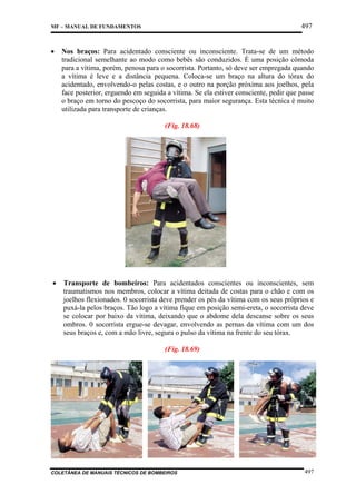 497

MF – MANUAL DE FUNDAMENTOS

•

Nos braços: Para acidentado consciente ou inconsciente. Trata-se de um método
tradicional semelhante ao modo como bebês são conduzidos. É uma posição cômoda
para a vítima, porém, penosa para o socorrista. Portanto, só deve ser empregada quando
a vítima é leve e a distância pequena. Coloca-se um braço na altura do tórax do
acidentado, envolvendo-o pelas costas, e o outro na porção próxima aos joelhos, pela
face posterior, erguendo em seguida a vítima. Se ela estiver consciente, pedir que passe
o braço em torno do pescoço do socorrista, para maior segurança. Esta técnica é muito
utilizada para transporte de crianças.
(Fig. 18.68)

•

Transporte de bombeiros: Para acidentados conscientes ou inconscientes, sem
traumatismos nos membros, colocar a vítima deitada de costas para o chão e com os
joelhos flexionados. 0 socorrista deve prender os pés da vítima com os seus próprios e
puxá-la pelos braços. Tão logo a vítima fique em posição semi-ereta, o socorrista deve
se colocar por baixo da vítima, deixando que o abdome dela descanse sobre os seus
ombros. 0 socorrista ergue-se devagar, envolvendo as pernas da vítima com um dos
seus braços e, com a mão livre, segura o pulso da vítima na frente do seu tórax.
(Fig. 18.69)

COLETÂNEA DE MANUAIS TÉCNICOS DE BOMBEIROS

497

 
