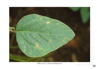 35 
MOR (Cs) (Fig. 2). Folha com múltiplas lesões. 
 
