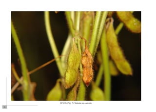 76 
AT (Ct) (Fig. 7). Sintoma no canivete. 
 