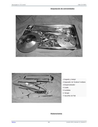 Descargado el: 15-12-2014 ISSN 1727-897X
Medisur 801 octubre 2014 | Volumen 12 | Numero 5
Amputación de extremidades
Histerectomía
 