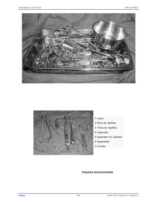 Descargado el: 15-12-2014 ISSN 1727-897X
Medisur 805 octubre 2014 | Volumen 12 | Numero 5
Columna instrumentada
 