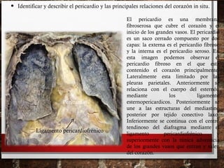 • Identificar y describir el pericardio y las principales relaciones del corazón in situ.
Pericardio
El pericardio es una membrana
fibroserosa que cubre el corazón y el
inicio de los grandes vasos. El pericardio
es un saco cerrado compuesto por dos
capas: la externa es el pericardio fibroso
y la interna es el pericardio seroso. En
esta imagen podemos observar el
pericardio fibroso en el que esta
contenido el corazón principalmente.
Lateralmente esta limitado por las
pleuras parietales. Anteriormente se
relaciona con el cuerpo del esternón
mediante los ligamento
esternopericardicos. Posteriormente se
une a las estructuras del mediastino
posterior por tejido conectivo laxo.
Inferiormente se continua con el centro
tendinoso del diafragma mediante el
ligamento pericardiofrénico y
superiormente con la túnica adventicia
de los grandes vasos que entran y salen
del corazón.
Ligamento pericardiofrénico
 