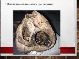 • Identificar aorta, arteria pulmonar y venas pulmonares.
Aorta
Arteria pulmonar
Venas pulmonares
 