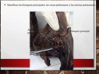• Identificar los bronquios principales, las venas pulmonares y las arterias pulmonares.
Bronquio principal
Arterias
pulmonares
Venas pulmonares
 