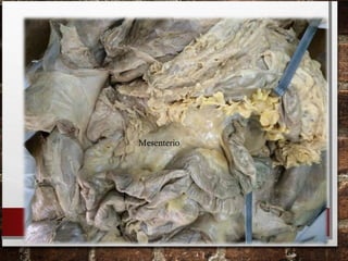 Mesenterio
 
