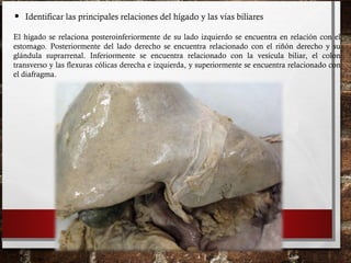 • Identificar las principales relaciones del hígado y las vías biliares
El hígado se relaciona posteroinferiormente de su lado izquierdo se encuentra en relación con el
estomago. Posteriormente del lado derecho se encuentra relacionado con el riñón derecho y su
glándula suprarrenal. Inferiormente se encuentra relacionado con la vesícula biliar, el colon
transverso y las flexuras cólicas derecha e izquierda, y superiormente se encuentra relacionado con
el diafragma.
 