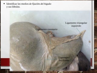 • Identificar los medios de fijación del hígado
y sus lóbulos.
Ligamento triangular
izquierdo
Ligamento coronario
Ligamento
falciforme
 