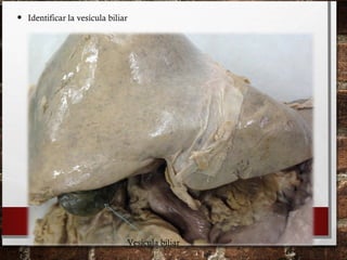 • Identificar la vesícula biliar
Vesícula biliar
 