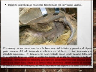 • Describir las principales relaciones del estomago con las vísceras vecinas.
El estomago se encuentra anterior a la bolsa omental, inferior y posterior al hígado,
posteriormente del lado izquierdo se relaciona con el bazo, el riñón izquierdo y su
glándula suprarrenal. Del lado derecho tiene contacto con el lóbulo derecho del hígado
y la vesícula biliar así como el conducto cístico, el conducto hepático y parte del
colédoco. Inferiormente se relaciona con parte del colon transverso que asciende por su
curvatura mayor hasta llegar a la flexura cólica izquierda. Anteriormente el estomago
se relaciona con el diafragma, el lóbulo izquierdo del hígado y la pared anterior del
abdomen.
 