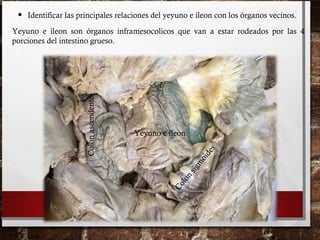 • Identificar las principales relaciones del yeyuno e íleon con los órganos vecinos.
Yeyuno e íleon
Colon transverso
Colonascendente
Ciego
Yeyuno e íleon
Colonascendente
Colon
sigm
oides
Yeyuno e íleon son órganos inframesocolicos que van a estar rodeados por las 4
porciones del intestino grueso.
 