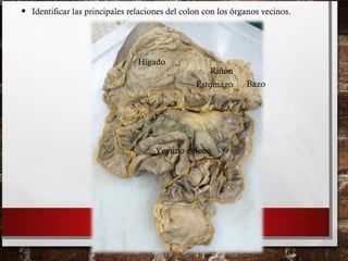 • Identificar las principales relaciones del colon con los órganos vecinos.
Hígado
Estomago
Yeyuno e íleon
Bazo
Riñón
 
