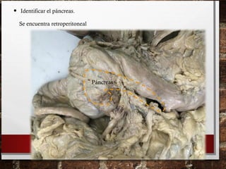 • Identificar el páncreas.
Páncreas
Se encuentra retroperitoneal
 