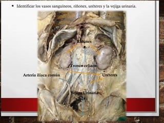 • Identificar los vasos sanguíneos, riñones, uréteres y la vejiga urinaria.
Riñones
Uréteres
Vejiga Urinaria
Tronco celiaco
Arteria iliaca común
 