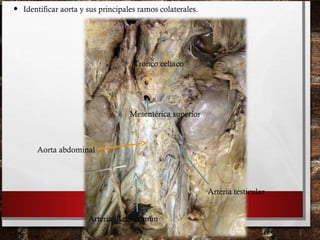 • Identificar aorta y sus principales ramos colaterales.
Tronco celiaco
Mesentérica superior
Aorta abdominal
Arteria testicular
Arteria iliaca común
 