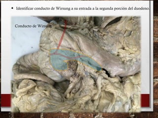 • Identificar conducto de Wirsung a su entrada a la segunda porción del duodeno.
Conducto de Wirsung
 