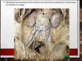 • Identificar las relaciones de los uréteres con estructuras anatómicas vecinas hasta
su entrada a la vejiga.
Uréteres
 