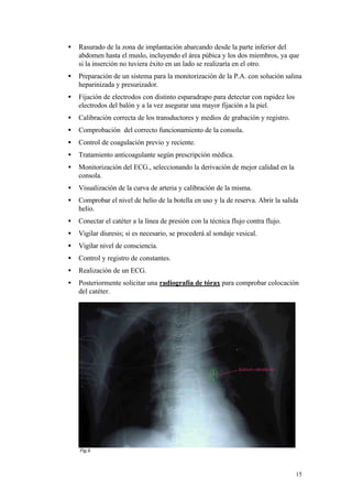 •   Rasurado de la zona de implantación abarcando desde la parte inferior del
    abdomen hasta el muslo, incluyendo el área púbica y los dos miembros, ya que
    si la inserción no tuviera éxito en un lado se realizaría en el otro.
•   Preparación de un sistema para la monitorización de la P.A. con solución salina
    heparinizada y presurizador.
•   Fijación de electrodos con distinto esparadrapo para detectar con rapidez los
    electrodos del balón y a la vez asegurar una mayor fijación a la piel.
•   Calibración correcta de los transductores y medios de grabación y registro.
•   Comprobación del correcto funcionamiento de la consola.
•   Control de coagulación previo y reciente.
•   Tratamiento anticoagulante según prescripción médica.
•   Monitorización del ECG., seleccionando la derivación de mejor calidad en la
    consola.
•   Visualización de la curva de arteria y calibración de la misma.
•   Comprobar el nivel de helio de la botella en uso y la de reserva. Abrir la salida
    helio.
•   Conectar el catéter a la línea de presión con la técnica flujo contra flujo.
•   Vigilar diuresis; si es necesario, se procederá al sondaje vesical.
•   Vigilar nivel de consciencia.
•   Control y registro de constantes.
•   Realización de un ECG.
•   Posteriormente solicitar una radiografía de tórax para comprobar colocación
    del catéter.




    Fig.9




                                                                                    15
 