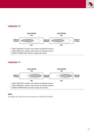41
LADO CÔNCAVO
LADO CONVEXO
TOPO TOPO
RAIZ RAIZ
LADO CÔNCAVO: Contato muito próximo do Diâmetro Interno.
AÇÕES CORRETIVAS: Reduzir a folga entre dentes.
LADO CONVEXO: Contato muito próximo do Diâmetro Externo.
DIÂMETRO
EXTERNO
DIÂMETRO
EXTERNO
DIÂMETRO
INTERNO
LADO CÔNCAVO
LADO CONVEXO
TOPO TOPO
RAIZ RAIZ
LADO CÔNCAVO: Contato muito próximo do Diâmetro Externo.
AÇÕES CORRETIVAS: Aumentar a folga entre dentes.
LADO CONVEXO: Contato muito próximo do Diâmetro Interno.
DIÂMETRO
EXTERNO
DIÂMETRO
EXTERNO
DIÂMETRO
INTERNO
CONDIÇÃO “E”
CONDIÇÃO “F”
NOTA:
Os padrões de contato descritos são sempre nos DENTES DA COROA.
 
