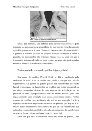 Manual de Massagem Terapêutica                      Mario-Paul Cassar




     Estas, por exemplo, são tratadas pelo aumento na pressão e pela
repetição do movimento. A intensidade do movimento é imediatamente
reduzida quando uma área de "fraqueza" é encontrada; de modo similar,
a pressão é aliviada quando os próprios nódulos começam a ceder à
pressão. Os movimentos são repetidos várias vezes e, uma vez que o
tratamento seja completado em uma região, as mãos são posicionadas
em outra área e o procedimento é reiniciado.


     Tratamento de pontos de gatilho (trigger points)


     Um ponto de gatilho (Travell 1983, p. 12) é localizado pela
avaliação de uma área de tecido que tende a abrigar um nódulo
hipersensível. Os pontos de gatilho podem ser encontrados em tecido
fascial e muscular, em ligamentos ou tendões, em tecido cicatricial ou
em níveis profundos, dentro de uma cápsula de articulação ou no
periósteo do osso. A palpação dessa zona de reflexo enviará, para uma
região distante, uma sensação mais intensa ou mesmo simples. Pontos
comuns de gatilho com freqüência são ativos; um exemplo é a área
superior do músculo esplênio da cabeça e do pescoço (ver Figura 1.2).
Outros locais recorrentes para pontos de gatilho são encontrados nos
músculos esternoclidomastóideo, elevador da escapula, fibras inferiores
do grande dorsal, infra-espinhoso, trapézio e rombóide.
     Uma vez que seja estabelecida como um ponto de gatilho, uma
 