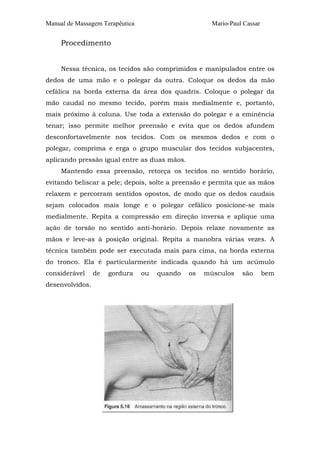 Manual de Massagem Terapêutica                        Mario-Paul Cassar


     Procedimento


     Nessa técnica, os tecidos são comprimidos e manipulados entre os
dedos de uma mão e o polegar da outra. Coloque os dedos da mão
cefálica na borda externa da área dos quadris. Coloque o polegar da
mão caudal no mesmo tecido, porém mais medialmente e, portanto,
mais próximo à coluna. Use toda a extensão do polegar e a eminência
tenar; isso permite melhor preensão e evita que os dedos afundem
desconfortavelmente nos tecidos. Com os mesmos dedos e com o
polegar, comprima e erga o grupo muscular dos tecidos subjacentes,
aplicando pressão igual entre as duas mãos.
     Mantendo essa preensão, retorça os tecidos no sentido horário,
evitando beliscar a pele; depois, solte a preensão e permita que as mãos
relaxem e percorram sentidos opostos, de modo que os dedos caudais
sejam colocados mais longe e o polegar cefálico posicione-se mais
medialmente. Repita a compressão em direção inversa e aplique uma
ação de torsão no sentido anti-horário. Depois relaxe novamente as
mãos e leve-as à posição original. Repita a manobra várias vezes. A
técnica também pode ser executada mais para cima, na borda externa
do tronco. Ela é particularmente indicada quando há um acúmulo
considerável     de   gordura    ou   quando   os   músculos    são       bem
desenvolvidos.
 