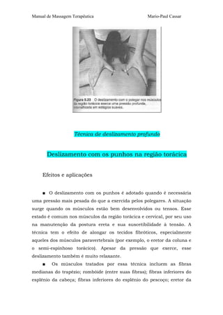 Manual de Massagem Terapêutica                      Mario-Paul Cassar




                    Técnica de deslizamento profundo


         Deslizamento com os punhos na região torácica


     Efeitos e aplicações


     ■ O deslizamento com os punhos é adotado quando é necessária
uma pressão mais pesada do que a exercida pelos polegares. A situação
surge quando os músculos estão bem desenvolvidos ou tensos. Esse
estado é comum nos músculos da região torácica e cervical, por seu uso
na manutenção da postura ereta e sua suscetibilidade à tensão. A
técnica tem o efeito de alongar os tecidos fibróticos, especialmente
aqueles dos músculos paravertebrais (por exemplo, o eretor da coluna e
o semi-espinhoso torácico). Apesar da pressão que exerce, esse
deslizamento também é muito relaxante.
     ■    Os músculos tratados por essa técnica incluem as fibras
medianas do trapézio; rombóide (entre suas fibras); fibras inferiores do
esplênio da cabeça; fibras inferiores do esplênio do pescoço; eretor da
 