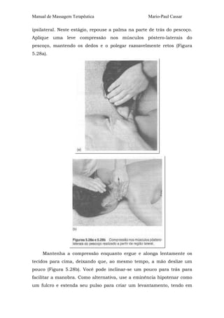 Manual de Massagem Terapêutica                      Mario-Paul Cassar

ipsilateral. Neste estágio, repouse a palma na parte de trás do pescoço.
Aplique uma leve compressão nos músculos póstero-laterais do
pescoço, mantendo os dedos e o polegar razoavelmente retos (Figura
5.28a).




     Mantenha a compressão enquanto ergue e alonga lentamente os
tecidos para cima, deixando que, ao mesmo tempo, a mão deslize um
pouco (Figura 5.28b). Você pode inclinar-se um pouco para trás para
facilitar a manobra. Como alternativa, use a eminência hipotenar como
um fulcro e estenda seu pulso para criar um levantamento, tendo em
 
