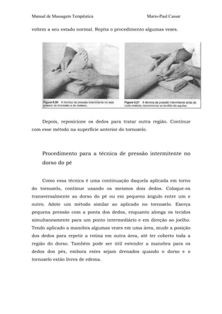 Manual de Massagem Terapêutica                         Mario-Paul Cassar

voltem a seu estado normal. Repita o procedimento algumas vezes.




     Depois, reposicione os dedos para tratar outra região. Continue
com esse método na superfície anterior do tornozelo.




     Procedimento para a técnica de pressão intermitente no
     dorso do pé


     Como essa técnica é uma continuação daquela aplicada em torno
do tornozelo, continue usando os mesmos dois dedos. Coloque-os
transversalmente ao dorso do pé ou em pequeno ângulo entre um e
outro. Adote um método similar ao aplicado no tornozelo. Exerça
pequena pressão com a ponta dos dedos, enquanto alonga os tecidos
simultaneamente para um ponto intermediário e em direção ao joelho.
Tendo aplicado a manobra algumas vezes em uma área, mude a posição
dos dedos para repetir a rotina em outra área, até ter coberto toda a
região do dorso. Também pode ser útil estender a manobra para os
dedos dos pés, embora estes sejam drenados quando o dorso e o
tornozelo estão livres de edema.
 