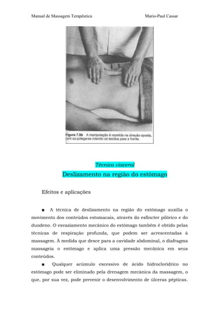Manual de Massagem Terapêutica                      Mario-Paul Cassar




                                 Técnica visceral
               Deslizamento na região do estômago

     Efeitos e aplicações


     ■   A técnica de deslizamento na região do estômago auxilia o
movimento dos conteúdos estomacais, através do esfíncter pilórico e do
duodeno. O esvaziamento mecânico do estômago também é obtido pelas
técnicas de respiração profunda, que podem ser acrescentadas à
massagem. À medida que desce para a cavidade abdominal, o diafragma
massageia o estômago e aplica uma pressão mecânica em seus
conteúdos.
     ■    Qualquer acúmulo excessivo de ácido hidroclorídrico no
estômago pode ser eliminado pela drenagem mecânica da massagem, o
que, por sua vez, pode prevenir o desenvolvimento de úlceras pépticas.
 