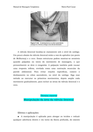 Manual de Massagem Terapêutica                           Mario-Paul Cassar




     A válvula ileocecal localiza-se exatamente sob o nível do umbigo.
Um pouco abaixo da válvula ileocecal estão a raiz do apêndice (no ponto
de McBurney) e o ceco. Essas estruturas podem mostrar-se sensíveis
quando palpadas no início do movimento de massagem, o que
provavelmente se deve à congestão. A palpação também pode causar
uma resposta reflexa, revelada como uma contração muscular da
parede   abdominal.     Para     evitar   reações   específicas,   comece    o
deslizamento no cólon ascendente, no nível do umbigo. Siga esse
método ao executar os primeiros movimentos, depois amplie cada
movimento gradualmente, para incluir as áreas da válvula ileocecal e o
ceco.




                                 Técnica visceral
            Manipulação da área da válvula ileocecal




     Efeitos e aplicações
     ■   A manipulação é aplicada para alongar os tecidos e reduzir
qualquer aderência dentro e em torno da fáscia profunda, do omento
 