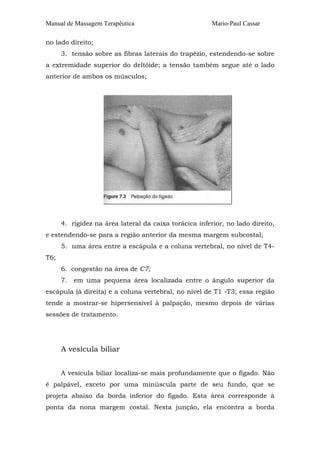 Manual de Massagem Terapêutica Mario-Paul Cassar
no lado direito;
3. tensão sobre as fibras laterais do trapézio, estendendo-se sobre
a extremidade superior do deltóide; a tensão também segue até o lado
anterior de ambos os músculos;
4. rigidez na área lateral da caixa torácica inferior, no lado direito,
e estendendo-se para a região anterior da mesma margem subcostal;
5. uma área entre a escápula e a coluna vertebral, no nível de T4-
T6;
6. congestão na área de C7;
7. em uma pequena área localizada entre o ângulo superior da
escápula (à direita) e a coluna vertebral, no nível de T1 -T3; essa região
tende a mostrar-se hipersensível à palpação, mesmo depois de várias
sessões de tratamento.
A vesícula biliar
A vesícula biliar localiza-se mais profundamente que o fígado. Não
é palpável, exceto por uma minúscula parte de seu fundo, que se
projeta abaixo da borda inferior do fígado. Esta área corresponde à
ponta da nona margem costal. Nesta junção, ela encontra a borda
 
