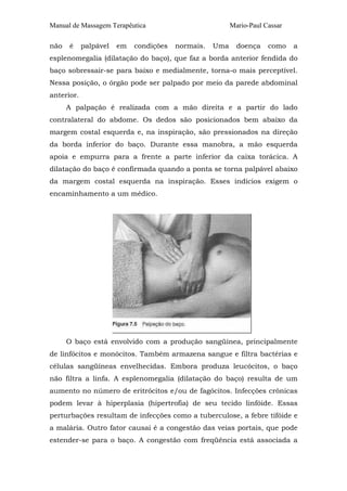 Manual de Massagem Terapêutica Mario-Paul Cassar
não é palpável em condições normais. Uma doença como a
esplenomegalia (dilatação do baço), que faz a borda anterior fendida do
baço sobressair-se para baixo e medialmente, torna-o mais perceptível.
Nessa posição, o órgão pode ser palpado por meio da parede abdominal
anterior.
A palpação é realizada com a mão direita e a partir do lado
contralateral do abdome. Os dedos são posicionados bem abaixo da
margem costal esquerda e, na inspiração, são pressionados na direção
da borda inferior do baço. Durante essa manobra, a mão esquerda
apoia e empurra para a frente a parte inferior da caixa torácica. A
dilatação do baço é confirmada quando a ponta se torna palpável abaixo
da margem costal esquerda na inspiração. Esses indícios exigem o
encaminhamento a um médico.
O baço está envolvido com a produção sangüínea, principalmente
de linfócitos e monócitos. Também armazena sangue e filtra bactérias e
células sangüíneas envelhecidas. Embora produza leucócitos, o baço
não filtra a linfa. A esplenomegalia (dilatação do baço) resulta de um
aumento no número de eritrócitos e/ou de fagócitos. Infecções crônicas
podem levar à hiperplasia (hipertrofia) de seu tecido linfóide. Essas
perturbações resultam de infecções como a tuberculose, a febre tifóide e
a malária. Outro fator causai é a congestão das veias portais, que pode
estender-se para o baço. A congestão com freqüência está associada a
 