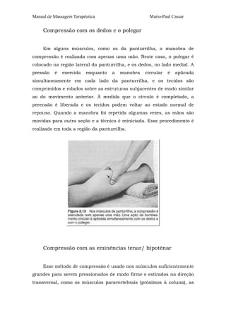 Manual de Massagem Terapêutica Mario-Paul Cassar
Compressão com os dedos e o polegar
Em alguns músculos, como os da panturrilha, a manobra de
compressão é realizada com apenas uma mão. Neste caso, o polegar é
colocado na região lateral da panturrilha, e os dedos, no lado medial. A
pressão é exercida enquanto a manobra circular é aplicada
simultaneamente em cada lado da panturrilha, e os tecidos são
comprimidos e rolados sobre as estruturas subjacentes de modo similar
ao do movimento anterior. À medida que o círculo é completado, a
preensão é liberada e os tecidos podem voltar ao estado normal de
repouso. Quando a manobra foi repetida algumas vezes, as mãos são
movidas para outra seção e a técnica é reiniciada. Esse procedimento é
realizado em toda a região da panturrilha.
Compressão com as eminências tenar/ hipotênar
Esse método de compressão é usado nos músculos suficientemente
grandes para serem pressionados de modo firme e estirados na direção
transversal, como os músculos paravertebrais (próximos à coluna), as
 