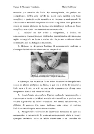 Manual de Massagem Terapêutica Mario-Paul Cassar
cercados por camadas de fáscia. Em conseqüência, não podem ser
comprimidos contra uma parede da fáscia para auxiliar seu fluxo
sangüíneo e, portanto, estão suscetíveis ao colapso e à varicosidade. O
amassamento também comprime os vasos sangüíneos mais profundos
contra os planos inferiores da fáscia, o que resulta em melhora do fluxo
sangüíneo nos vasos, tanto venosos quanto arteriais.
2. Redução da dor. Como a compressão, a técnica de
amassamento relaxa músculos contraídos, aumentando a circulação na
região e alongando as fibras. A melhor circulação tem o efeito adicional
de reduzir a dor e a fadiga nos músculos.
3. Melhora na drenagem linfática. O amassamento melhora a
drenagem linfática do tecido muscular e superficial.
A contração dos músculos faz os vasos linfáticos se comprimirem
contra os planos profundos da fáscia, o que tem o efeito de bombear a
linfa para a frente. A ação de aperto do amassamento oferece uma
compressão similar aos vasos linfáticos.
4. Emulsificação da gordura. Quando realizado vigorosamente, o
amassamento tende a produzir o efeito de emulsificar a gordura nas
células superficiais do tecido conjuntivo. Em estado emulsificado, os
glóbulos de gordura têm maior facilidade para entrar no sistema
linfático e também para serem metabolizados.
5. Alongamento e liberação de aderências. Sinônimo da ação da
compressão, o componente de torção do amassamento ajuda a romper
qualquer aderência entre os feixes musculares e as camadas de
 