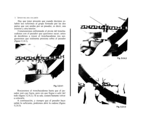 1. A PERTURA DEL ESLABÓN
    Hay que tener presente que cuando decimos es-
labón nos referimos al grupo formado por las dos
partes que son unidas por un pasador, es decir, una
exterior y otra interior.
    Comenzaremos enfrentando el pivote del troncha-
cadenas con el pasador que queremos sacar; antes
de decidirnos a roscar el tronchacadenas nos ase-
guraremos que realmente presiona sobre el pasador
(figura 3.2.4.1).




    Roscaremos el tronchacadenas hasta que el pa-
sador esté casi fuera, pero sin que llegue a salir del
todo (figura 3.2.4.2.). Si se sale, costará bastante volver
a colocarlo.
    A continuación, y siempre que el pasador haya
salido lo suficiente, podremos abrir la cadena (figura
3.2.4.3).
 