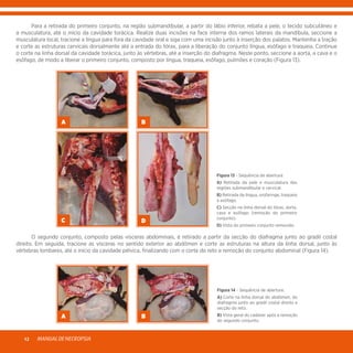 MANUALDENECROPSIA12
	 Para a retirada do primeiro conjunto, na região submandibular, a partir do lábio inferior, rebata a pele, o tecido subcutâneo e
a musculatura, até o início da cavidade torácica. Realize duas incisões na face interna dos ramos laterais da mandíbula, seccione a
musculatura local, tracione a língua para fora da cavidade oral e siga com uma incisão junto à inserção dos palatos. Mantenha a tração
e corte as estruturas cervicais dorsalmente até a entrada do tórax, para a liberação do conjunto língua, esôfago e traqueia. Continue
o corte na linha dorsal da cavidade torácica, junto às vértebras, até a inserção do diafragma. Neste ponto, seccione a aorta, a cava e o
esôfago, de modo a liberar o primeiro conjunto, composto por língua, traqueia, esôfago, pulmões e coração (Figura 13).
A B
C D
Figura 13 - Sequência de abertura:
A) Retirada da pele e musculatura das
regiões submandibular e cervical.
B) Retirada da língua, orofaringe, traqueia
e esôfago.
C) Secção na linha dorsal do tórax, aorta,
cava e esôfago (remoção do primeiro
conjunto).
D) Vista do primeiro conjunto removido.
	 O segundo conjunto, composto pelas vísceras abdominais, é retirado a partir da secção do diafragma junto ao gradil costal
direito. Em seguida, tracione as vísceras no sentido exterior ao abdômen e corte as estruturas na altura da linha dorsal, junto às
vértebras lombares, até o início da cavidade pélvica, finalizando com o corte do reto e remoção do conjunto abdominal (Figura 14).
A B
Figura 14 - Sequência de abertura:
A) Corte na linha dorsal do abdômen, do
diafragma junto ao gradil costal direito e
secção do reto.
B) Vista geral do cadáver após a remoção
do segundo conjunto.
 